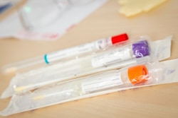 子宮頸がん検査キットの解説 口コミ 費用 使い方 自己採取のやり方など ブログ 30代医療従事者の異形成 治療体験記